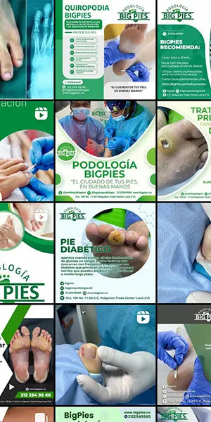 Feed de Instagram de Podologia Big Pies